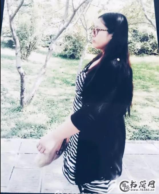 及伟佳现状与照片：最美女胖子瘦身前后对比照