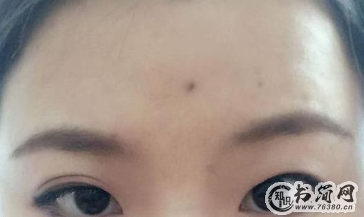 千金难买额头痣是为什么