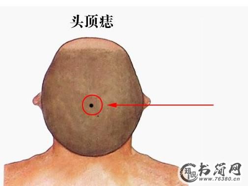 最有福气的10处吉痣:最后一个太隐蔽要好好保护