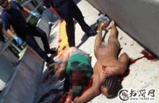 历史上真实的丧尸事件