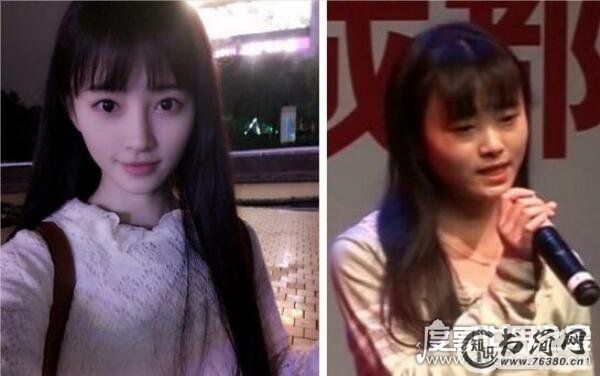 网传鞠婧祎整容是真的吗，鞠婧祎整容前后照片对比(判若两人)