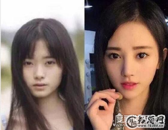 网传鞠婧祎整容是真的吗，鞠婧祎整容前后照片对比(判若两人)
