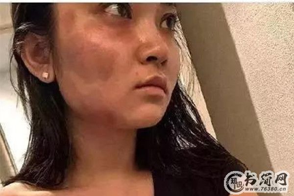 被男朋友打算不算家暴 如何定义家暴行为