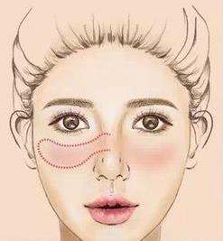 腮红怎么打：简单6款腮红画法看看哪款适合你