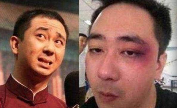 王自健被妻子家暴细节