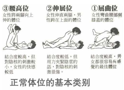 正常体位