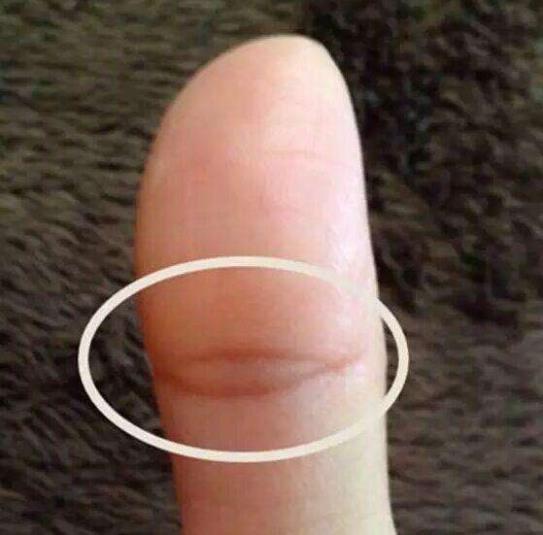 佛眼纹没有闭合是佛眼吗