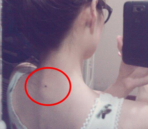 苦情痣长在哪里图解：苦情痣真的很命苦吗