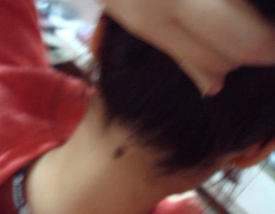 苦情痣长在哪里图解：苦情痣真的很命苦吗