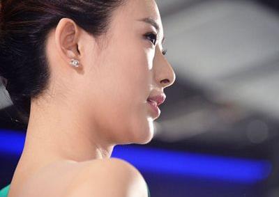 陈浩民承认整容