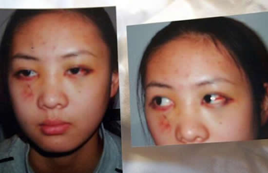 童瑶被张默打是因为什么 童瑶和张默分手原因曝光