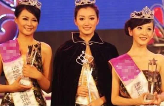 沈梦辰原来的样子曝光 沈梦辰整过容是真的吗