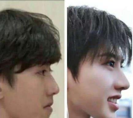 为什么大家都骂蔡徐坤？蔡徐坤整容前后对比照