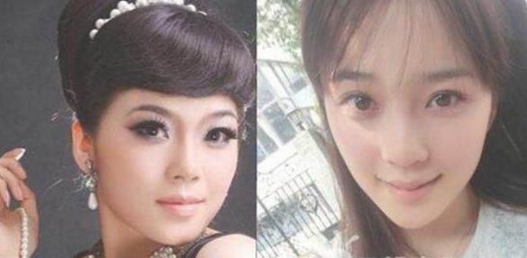 赵韩樱子老公是谁？赵韩樱子前后整容照片曝光（图）