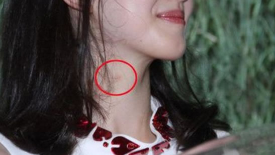 男女生为什么要吸草莓，成功种个草莓及消除方法