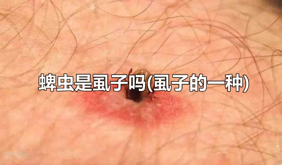 蜱虫是虱子吗(虱子的一种)