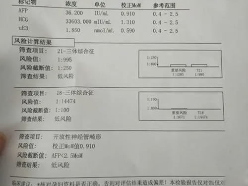 唐氏筛查看生男生女95%准吗(唐筛都查些什么)