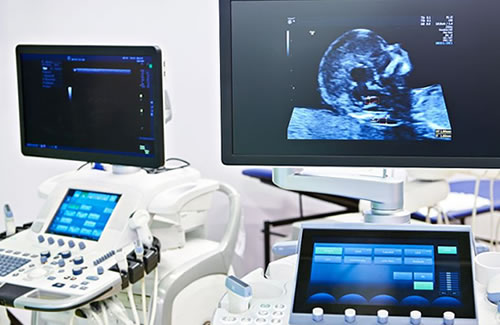 唐氏筛查看生男生女95%准吗(唐筛都查些什么)