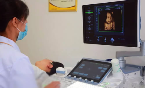 唐氏筛查看生男生女95%准吗(唐筛都查些什么)